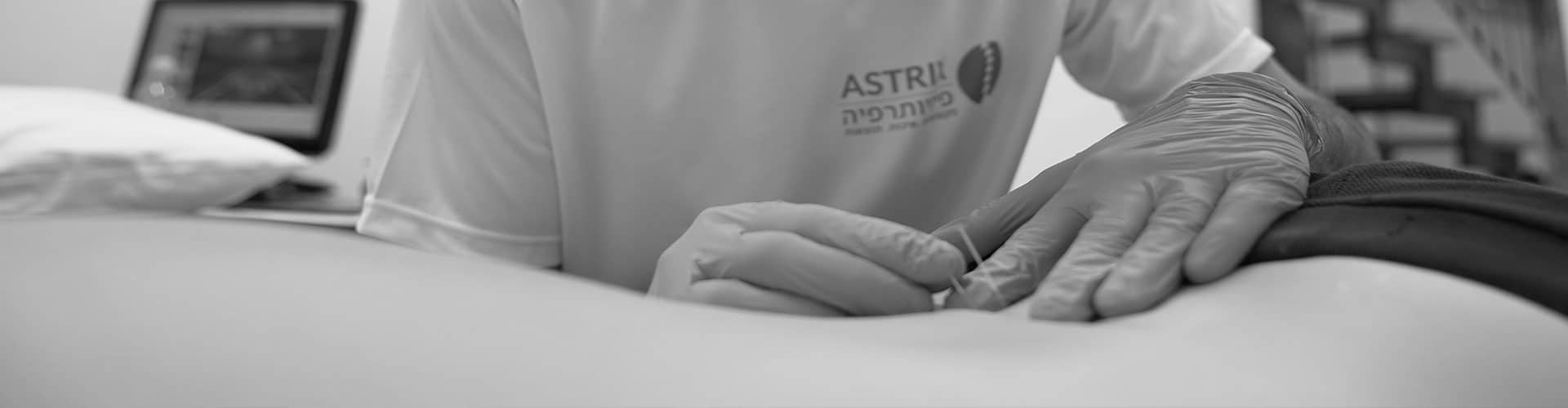 דיקור מערבי דיקור יבש